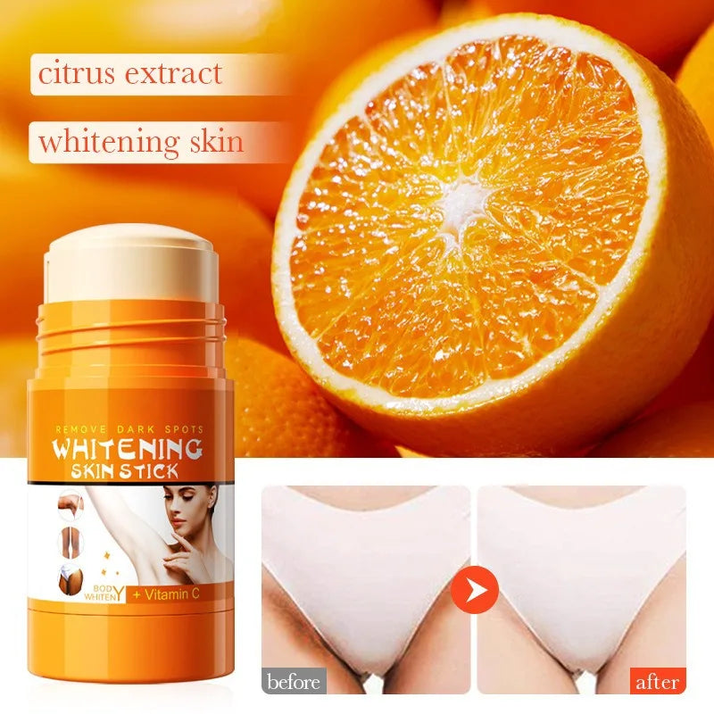 Vitamin C Knuckles Brightening Cream Hand Fast Lightening Cream Elbows Knee Black Skin Quickly Brighten Stains Remover Emulsion