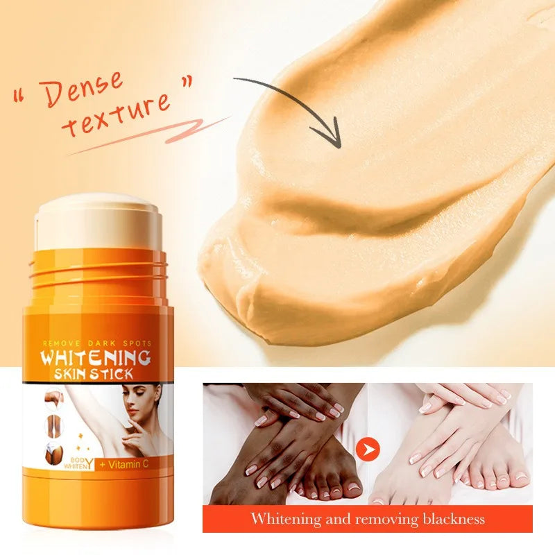 Vitamin C Knuckles Brightening Cream Hand Fast Lightening Cream Elbows Knee Black Skin Quickly Brighten Stains Remover Emulsion