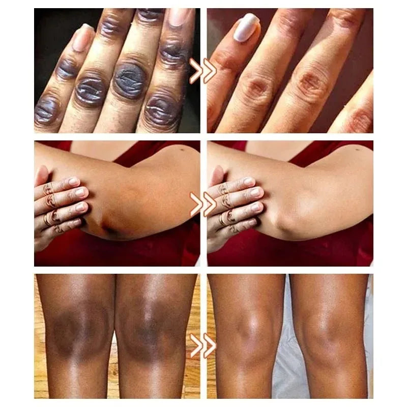 Vitamin C Knuckles Brightening Cream Hand Fast Lightening Cream Elbows Knee Black Skin Quickly Brighten Stains Remover Emulsion