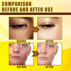 Yellow Peeling Oil Body Cleansing Exfoliation For Tender Glowing Skin Finger Joint Whitening Moisturizing Care Beauty Products