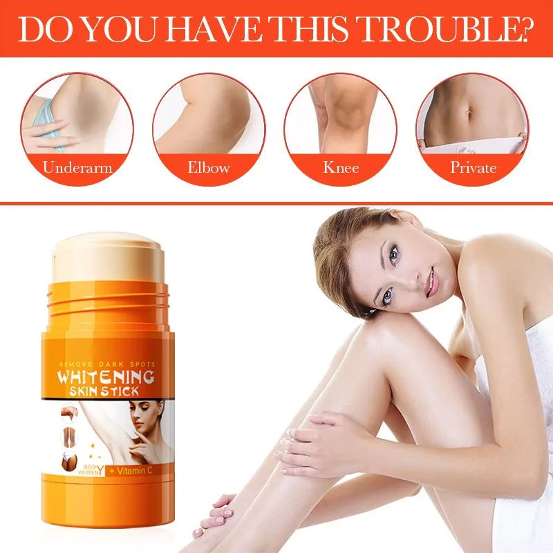 Vitamin C Knuckles Brightening Cream Hand Fast Lightening Cream Elbows Knee Black Skin Quickly Brighten Stains Remover Emulsion