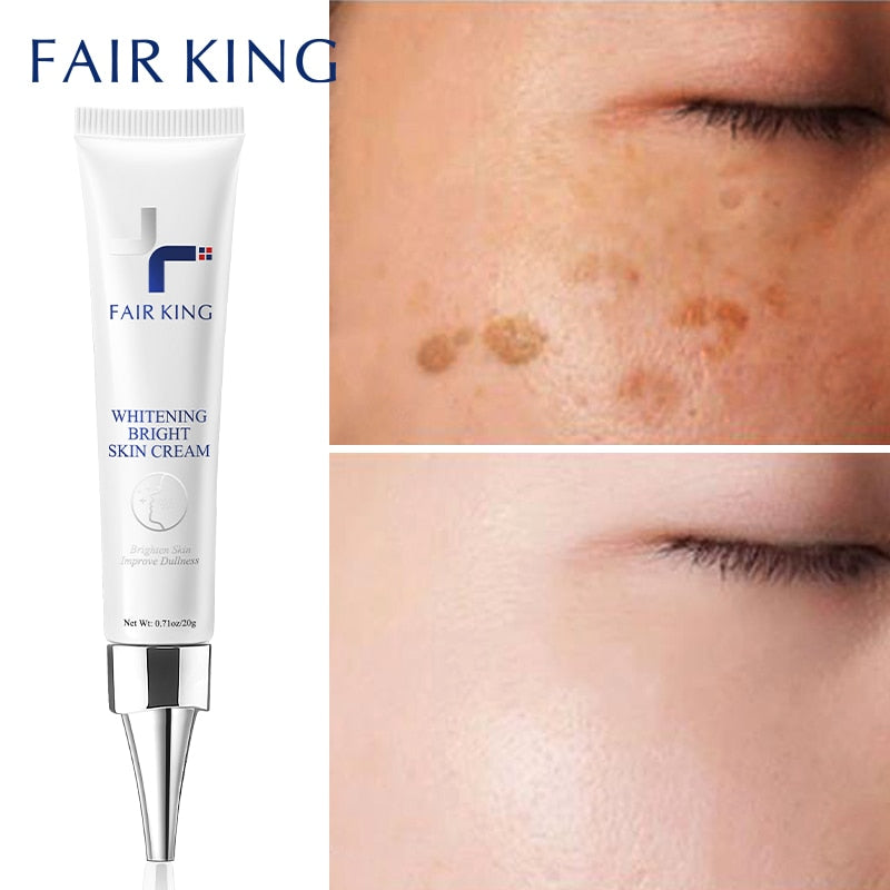 Dark Spot Corrector Skin Whitening Fade Cream Lightening Blemish Removal Serum Reduces Age Spots Freckles Face Cream 20g